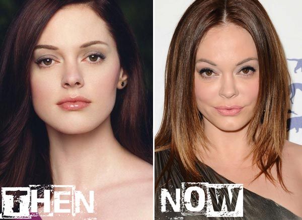 Rose McGowan Before and After