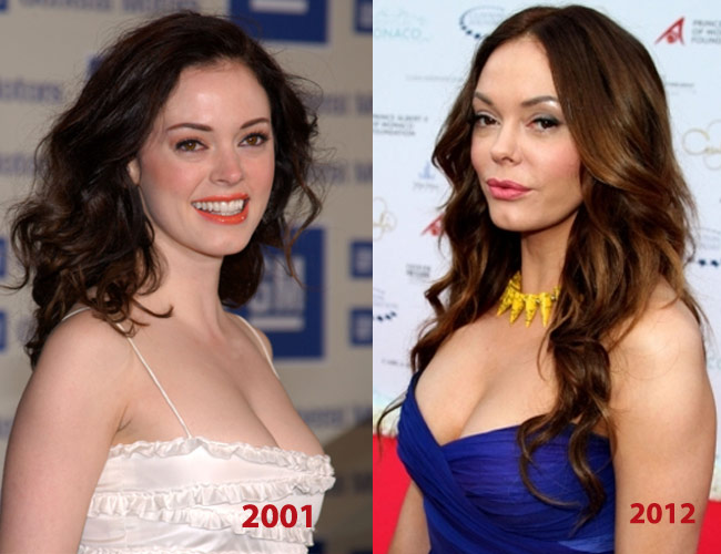 Rose McGowan Before and After