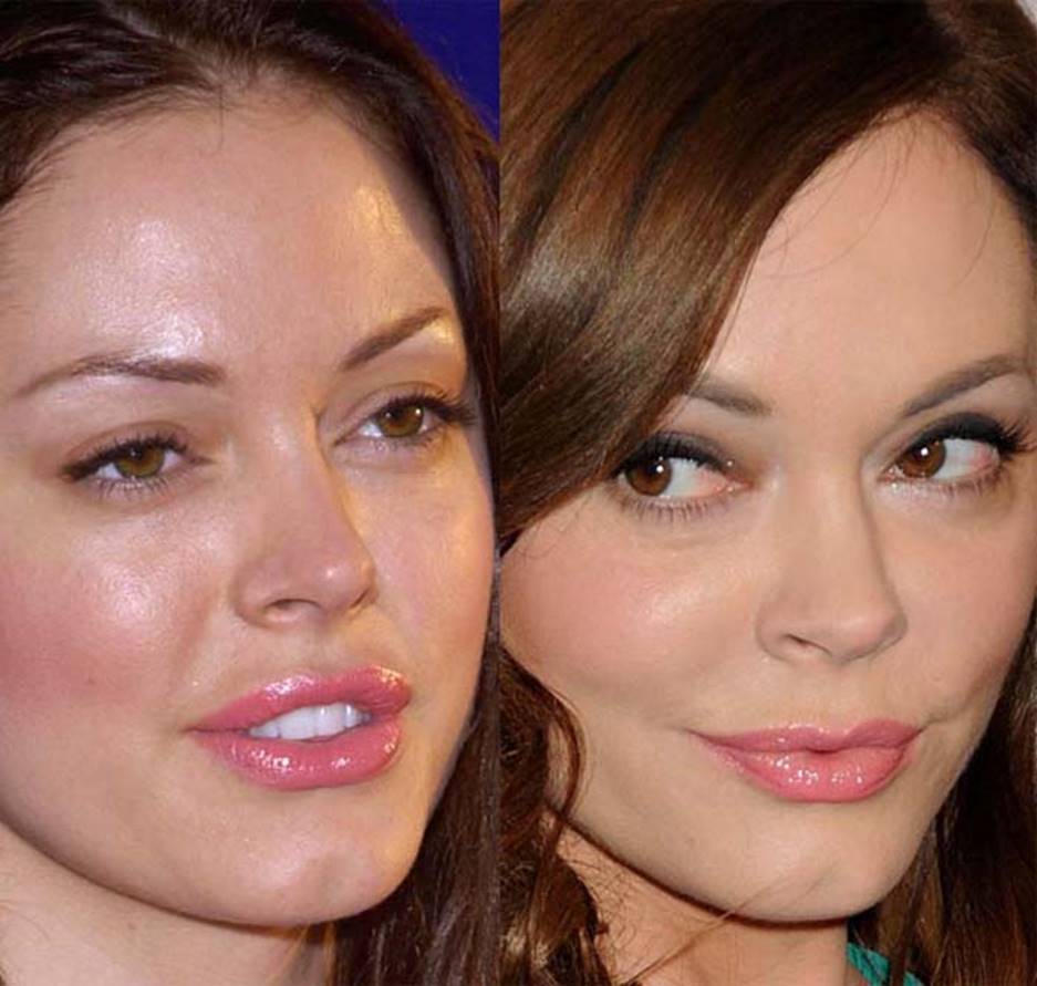 Rose McGowan Before and After