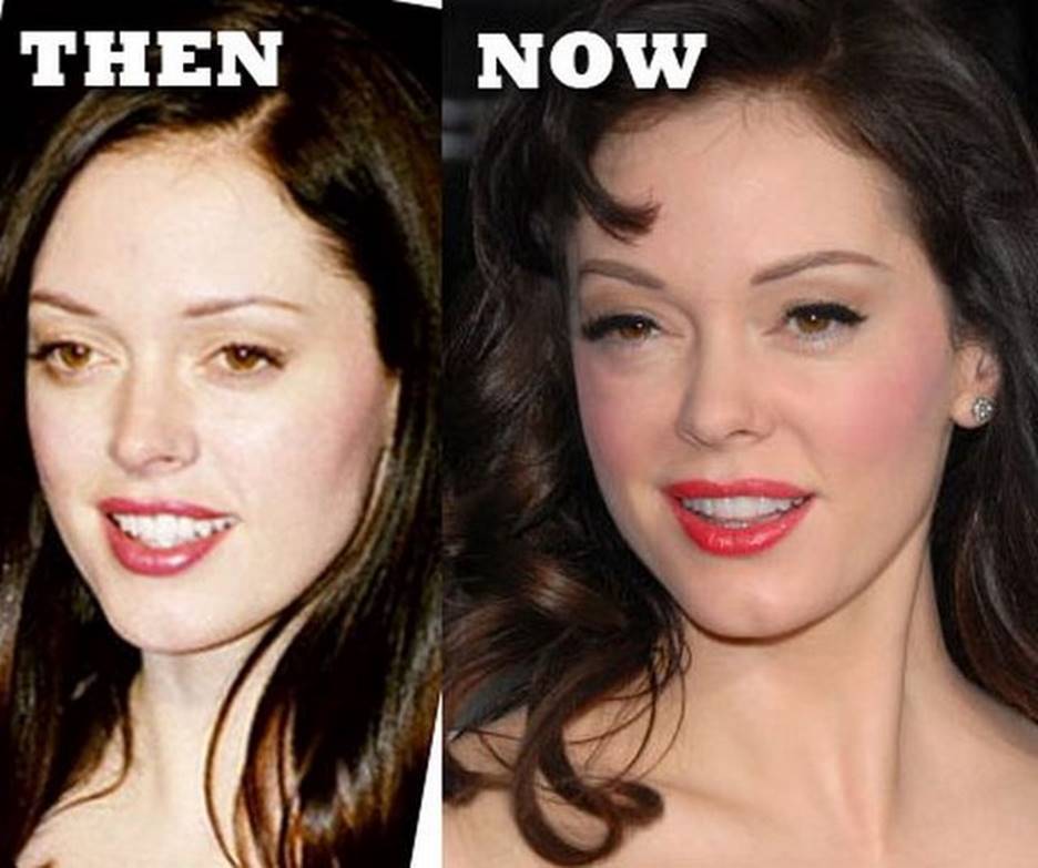 Rose McGowan Before and After