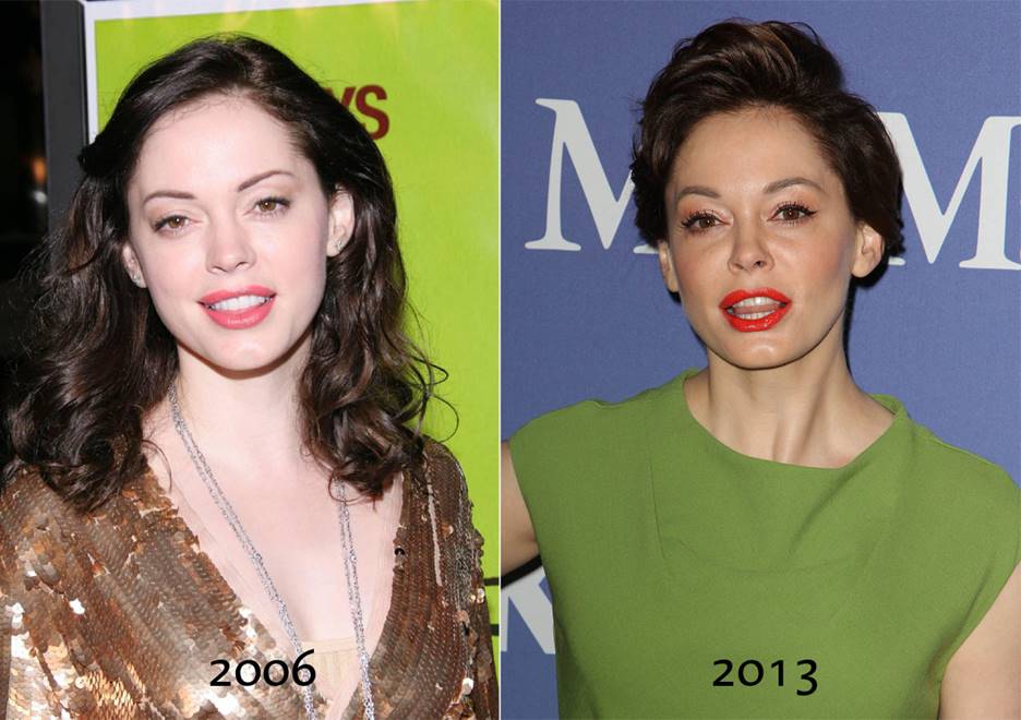 Rose McGowan Before and After