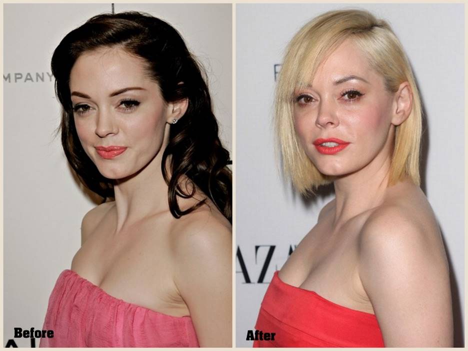 Rose McGowan Before and After